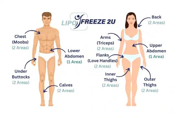 Areas you can have fat freezing treatment Burton upon Trent