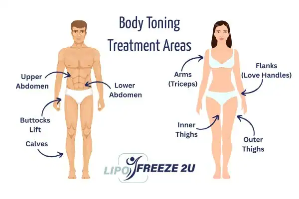 Graphic showing where you can have Body toning Treatment Burton upon Trent on your body