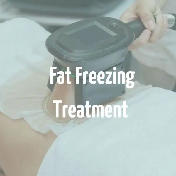 fat freezing treatment Burton upon Trent