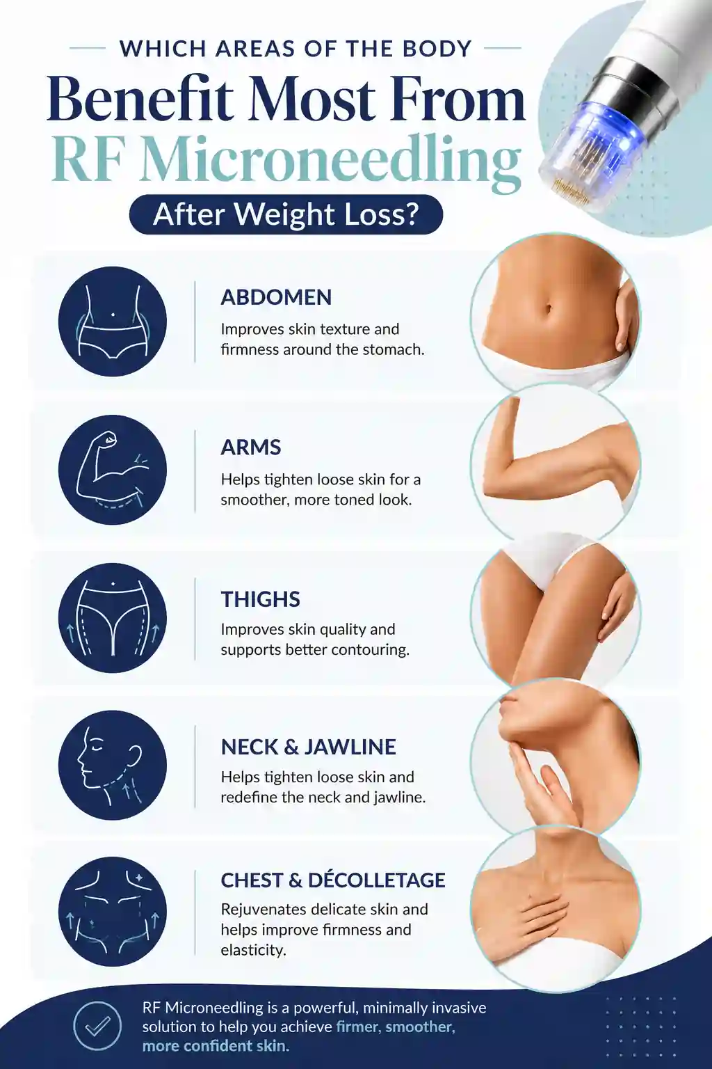 Which Areas of the Body Benefit Most From RF Microneedling After Weight Loss Burton upon Trent
